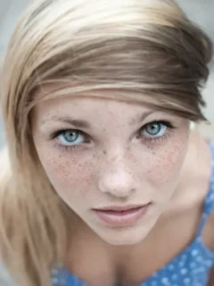 Freckles